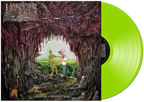Undeath - Lesions Of A Different Kind { vinyl }